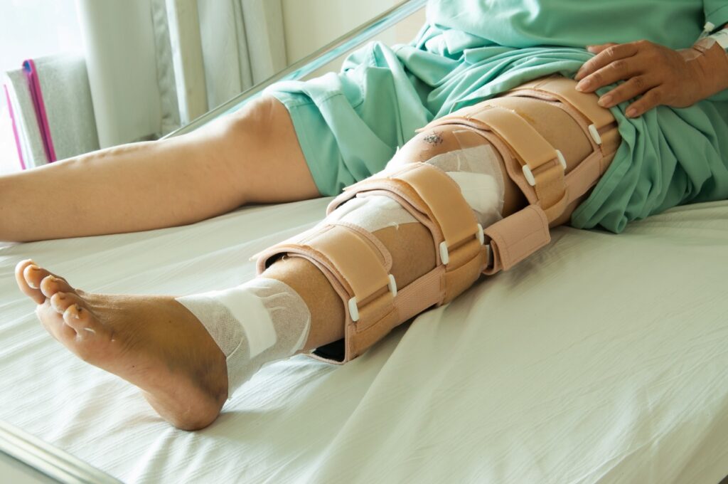 Woman wearing a leg brace