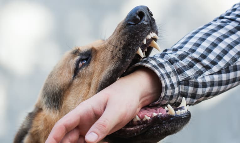 dog biting wrist of man