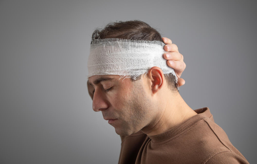 Concussion Injury 107 Concussion Injury
